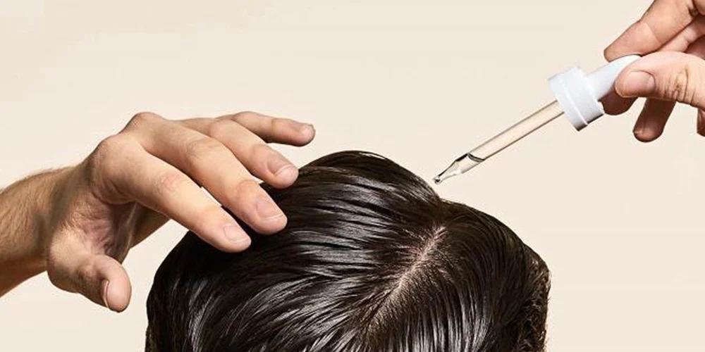 What is minoxidil and everything you need to know about it