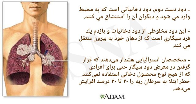 حرکتی که تاوان زندگی را دارد