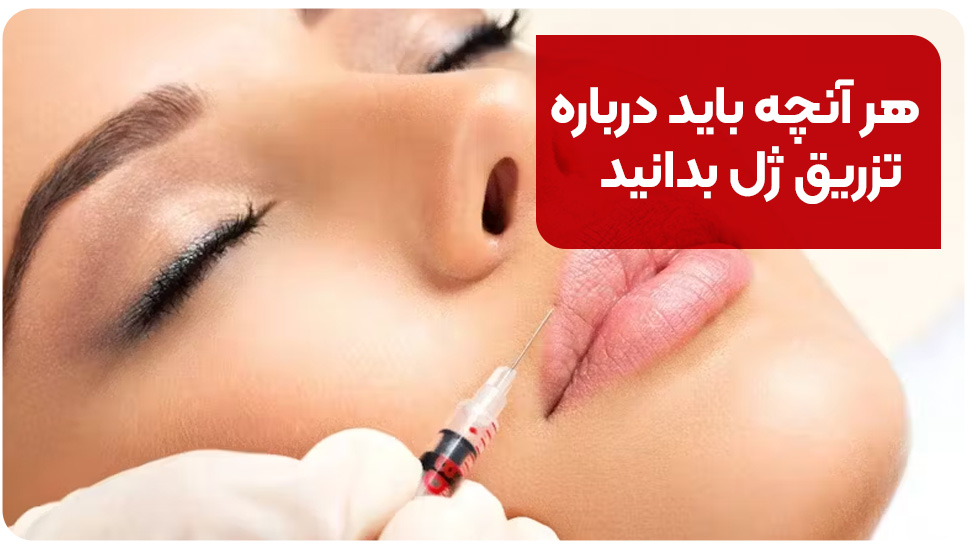 هر آنچه باید درباره تزریق ژل بدانید