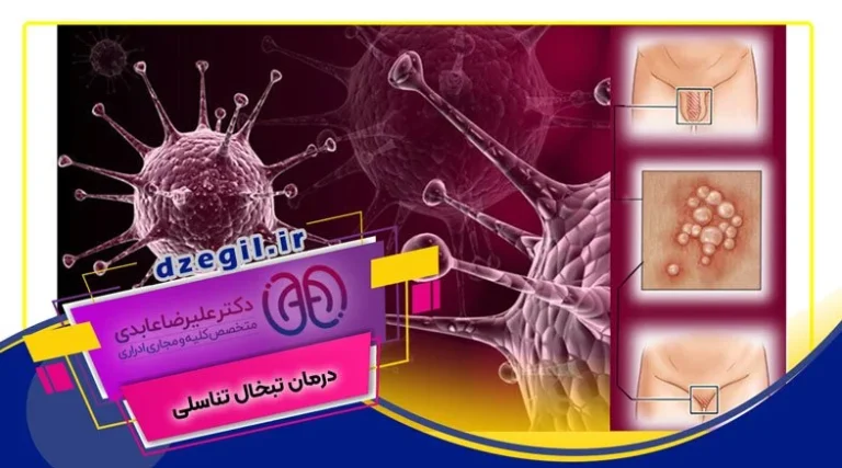 درمان آنژیوکراتوم با طب سنتی