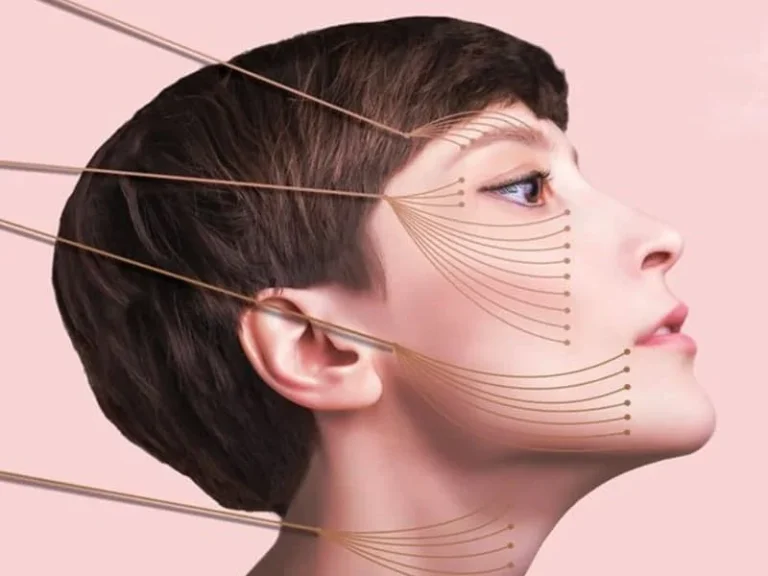 آیا شما نخ سیلوئیت را تائید می کنید؟