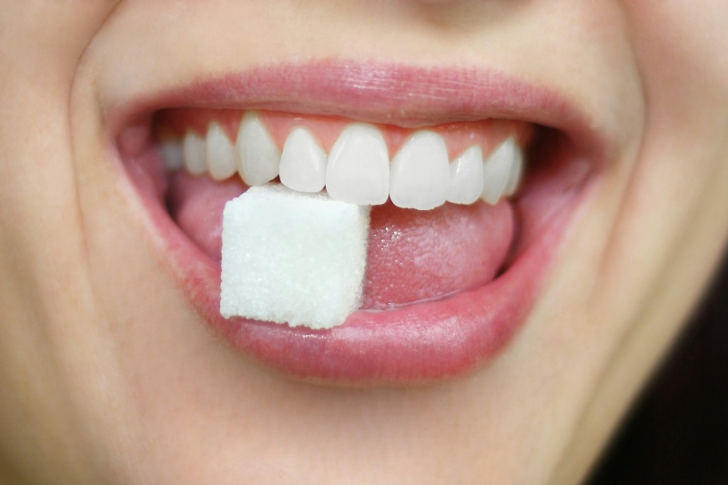 پوسیدگی تخریب فوری مینای دندان با قند