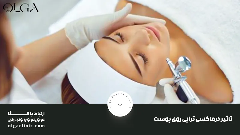 تاثیر درماکسی تراپی روی پوست